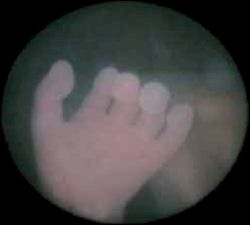 In utero (echografie)