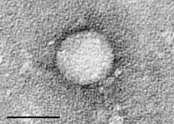 Micrographie du virus de l'hépatite C. Échelle = 50